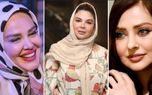 این خانم بازیگر خواستند با عمل زیباتر شوند / اما زشت تر شدند ! + عکس ها